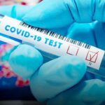 Kasus Posititif Covid-19 Bertambah 29 kasus Di NTT, Pada Perayaan Natal Hari ke-2.